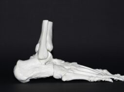 Sports Injuries