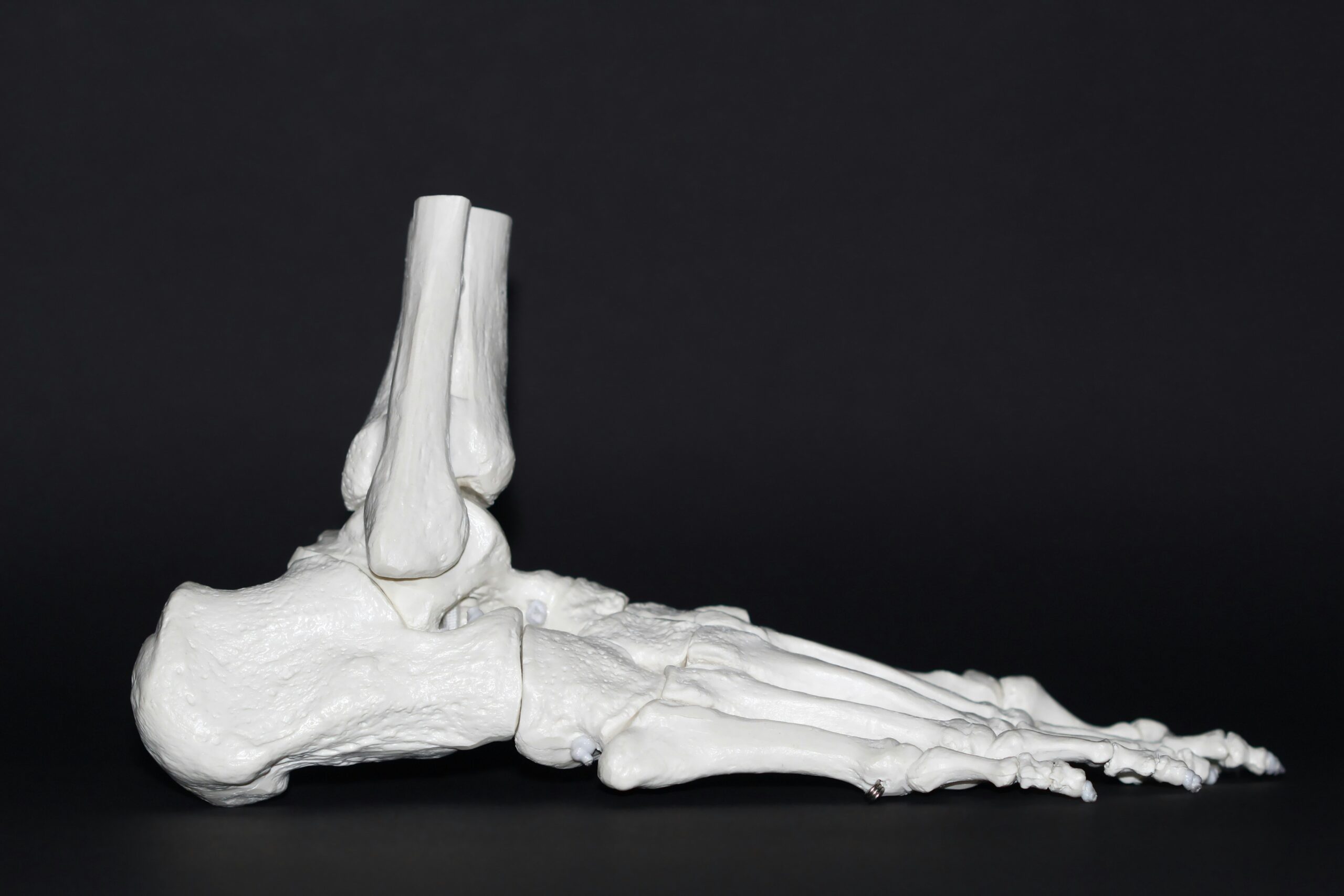Sports Injuries